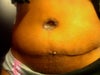 After Tummy tuck 3-4 weeks out