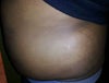 Love handles still prominent, again soft consistency even with workouts