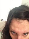 2 hours after injection