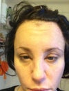 48 hours after injection