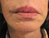 Lips