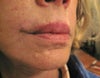 Lips2