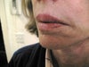 Lips3
