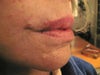 Lips4