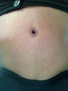 Belly button
