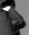 Nose Relaxed - Not Flared NOTE: Angle at Nostril