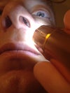 nostril