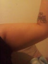 I have a little of the "flabby" issue under my arms that I would like gone
