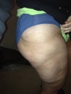 It's like I lost weight everywhere but the 10 inches from the top of my leg down.