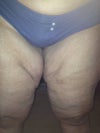 Look at all that extra skin---ewwwwwww!