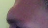 brow