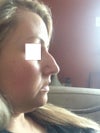 This is the concave side, I can actually feel inside my nose a pointed piece of skin I believe from where it's indented.