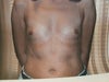 before surgery