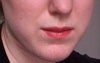 It looks like jowls are starting to appear here as well.