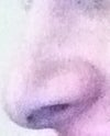 Side view while smiling. From the side I do notice a slight downward droop and my nostril "stretches" and gets a bit longer/bigger.