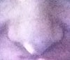 Nose frontal view while smiling.