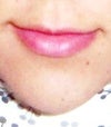 My upper lip is almost non-existent.