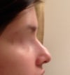 right side profile view