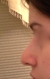 left side profile view, doesn't have the same lump as right side