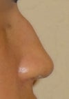 left