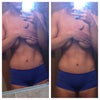 The dent is coming out more as I work my abs. I had a four pack prior too surgery just with a lb of skin hanging off and I never had that "dent" look before.