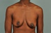Frontal View - asymmetrical