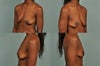 Profiles - breastfed, no volume