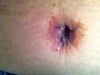 Belly button