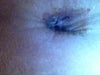 Belly button