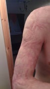 upper arm is the most effected with a really tight swirl above the middle.