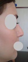 before-2