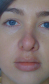 after (14 months)