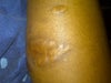 scar side view
