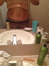 My gut after 1st baby