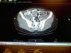 Shows the si joint and what there saying is a dysfuntion.
