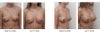 More photos of the results I want.