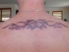 Tattoo following 4th treatment