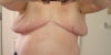 front view showing expanders under arms