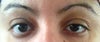 My eyes today