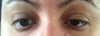My eyes today