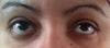 My eyes today