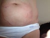 This is how swollen my belly is.