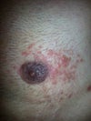 Left side, 10/10/12.
When it surfaced.