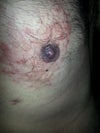 Right side, 10/10/12.
When it surfaced.