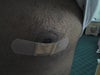Nipple turning black