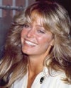Lower tooth show, like Farrah Fawcett had, should be possible with a procedure.
