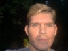 Taken at the start of Octover, 2012 before Juvederm under both eyes.