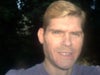 Taken at the start of October, 2012 before Juvederm under both eyes.