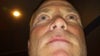 Front with different nostrils