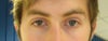 My Eyes